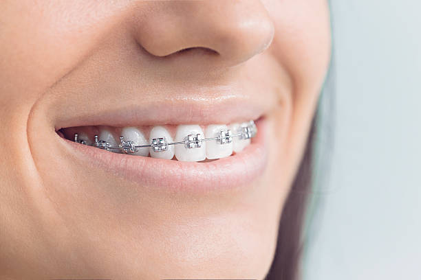 Best Wisdom Tooth Removal  in Gordon, GA